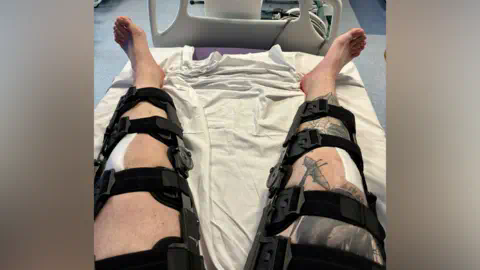 Dan Jones Dan Jones's legs strapped up in supports while he lies on a hospital bed